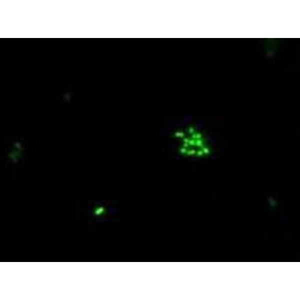 Hund Mikroskop H 600 Wilo-Brau, bino, 100x - 630x