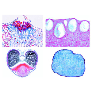 LIEDER Mehl- und Stärkesorten, Verunreinigungen und Verfälschungen, Treibmittel  (25 Präp)